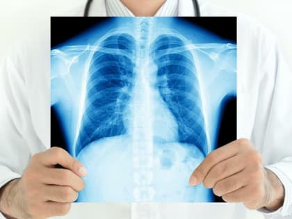 Туберкулез — памятка для населения