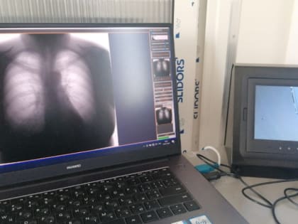 Почему в Волгодонске не функционируют кабинеты флюорографии