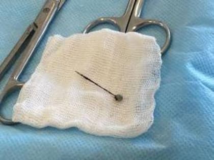 В Ростове спасли мальчика, который два года жил с иголкой в легком