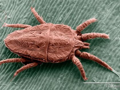 В Ростовской области Роспотребнадзор сообщил о начале сезона клещей