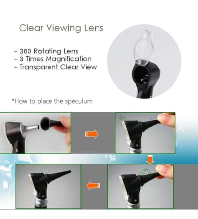 Magnification Diagnostic Otoscope with LED Direct Illuminati – photo 4 in Kanata
