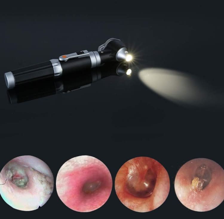 Magnification Diagnostic Otoscope with LED Direct Illuminati – photo 5 in Kanata
