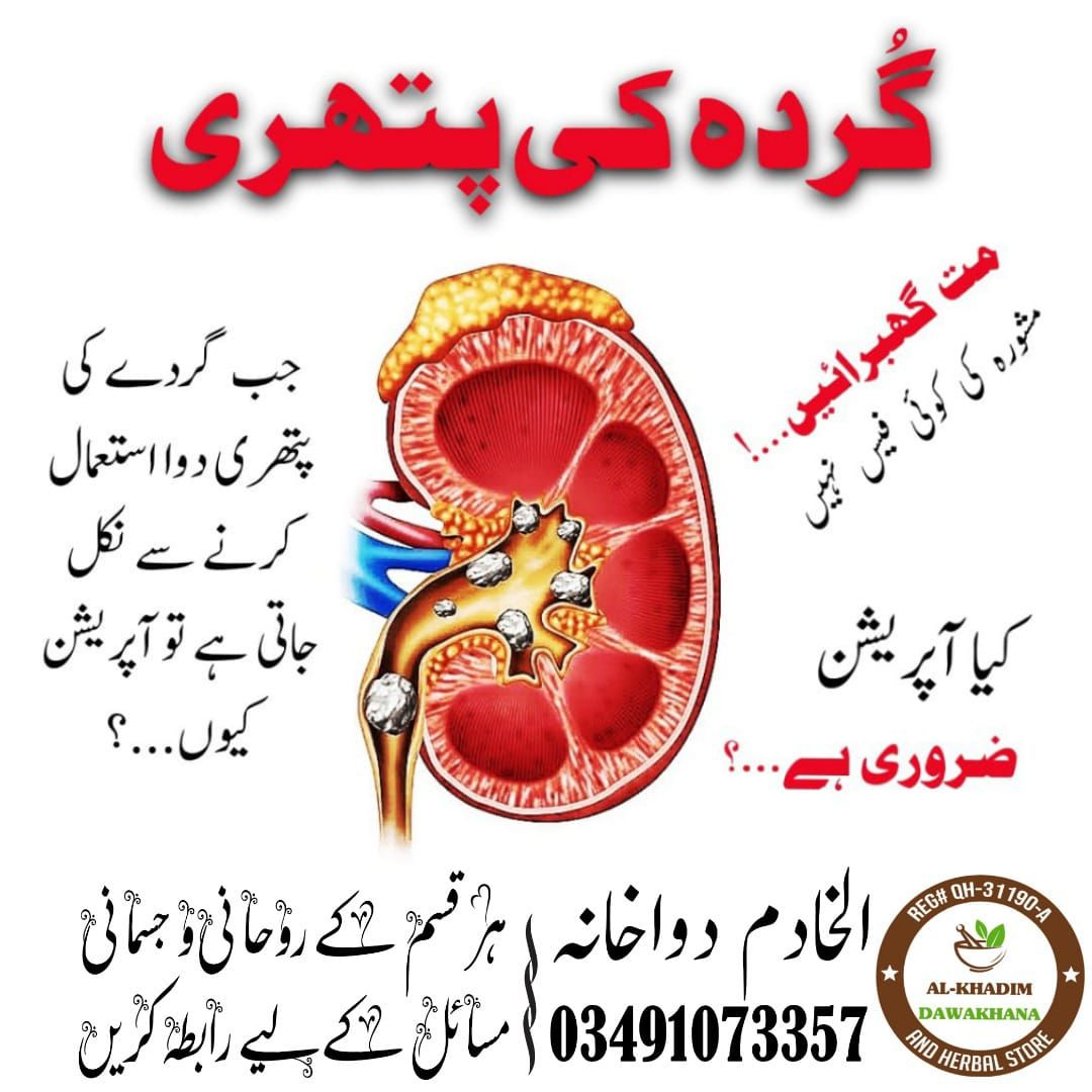 گردہ کی پتھری