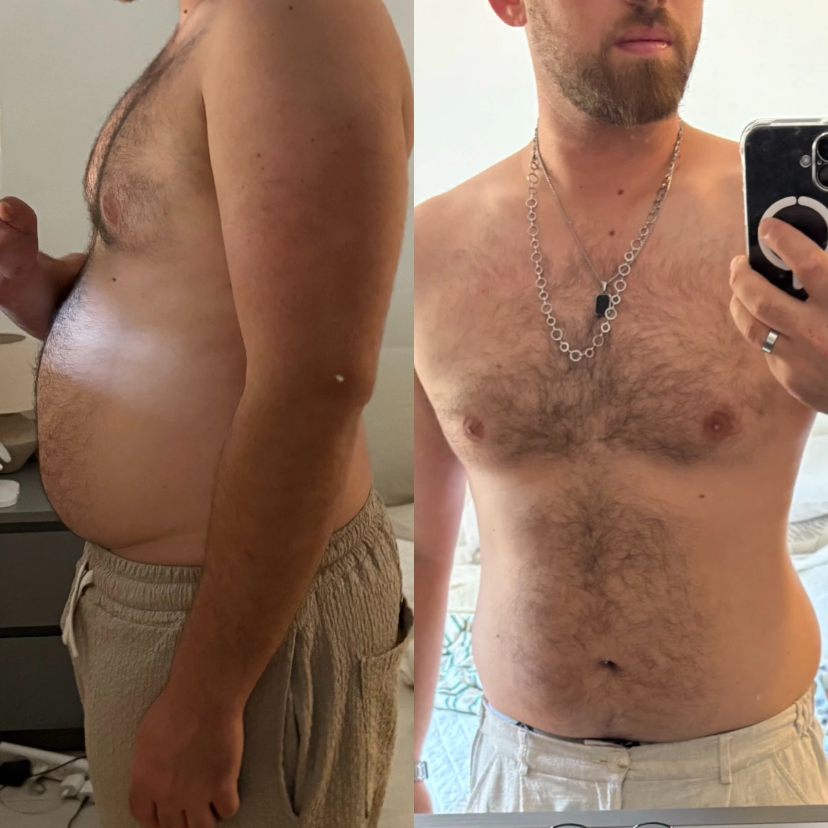 תמונת לפני ואחרי של אוהד