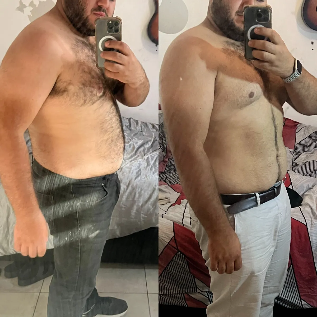 תמונת לפני ואחרי של עילאי