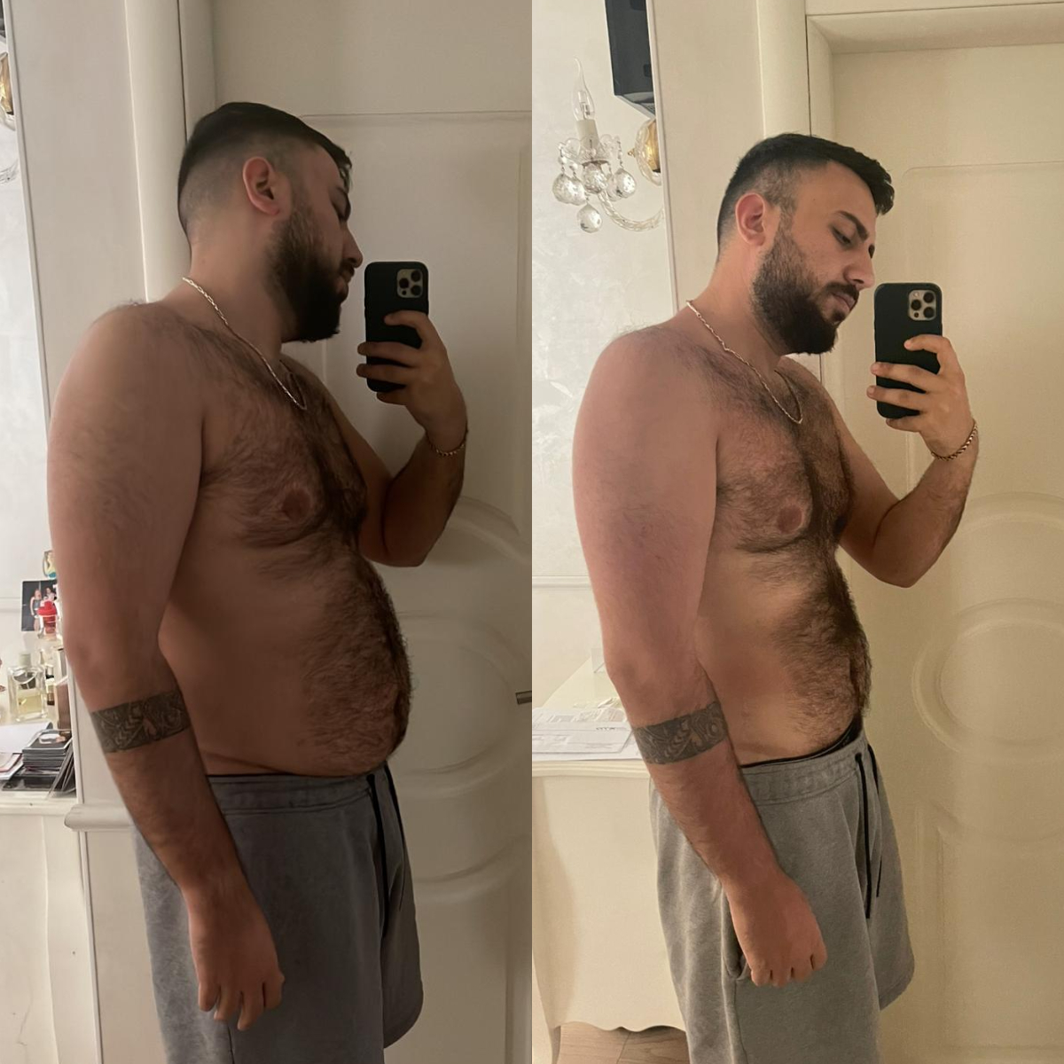 תמונת לפני ואחרי של רפאל