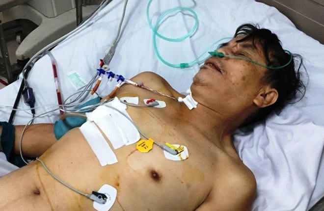 Nạn nhân bị vỡ tim sau tai nạn giao thông được cứu sống kỳ diệu