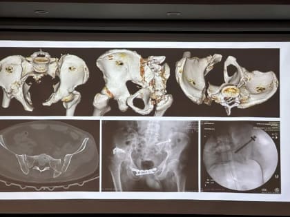 Хирурги БМСП продолжают расширять свои компетенции