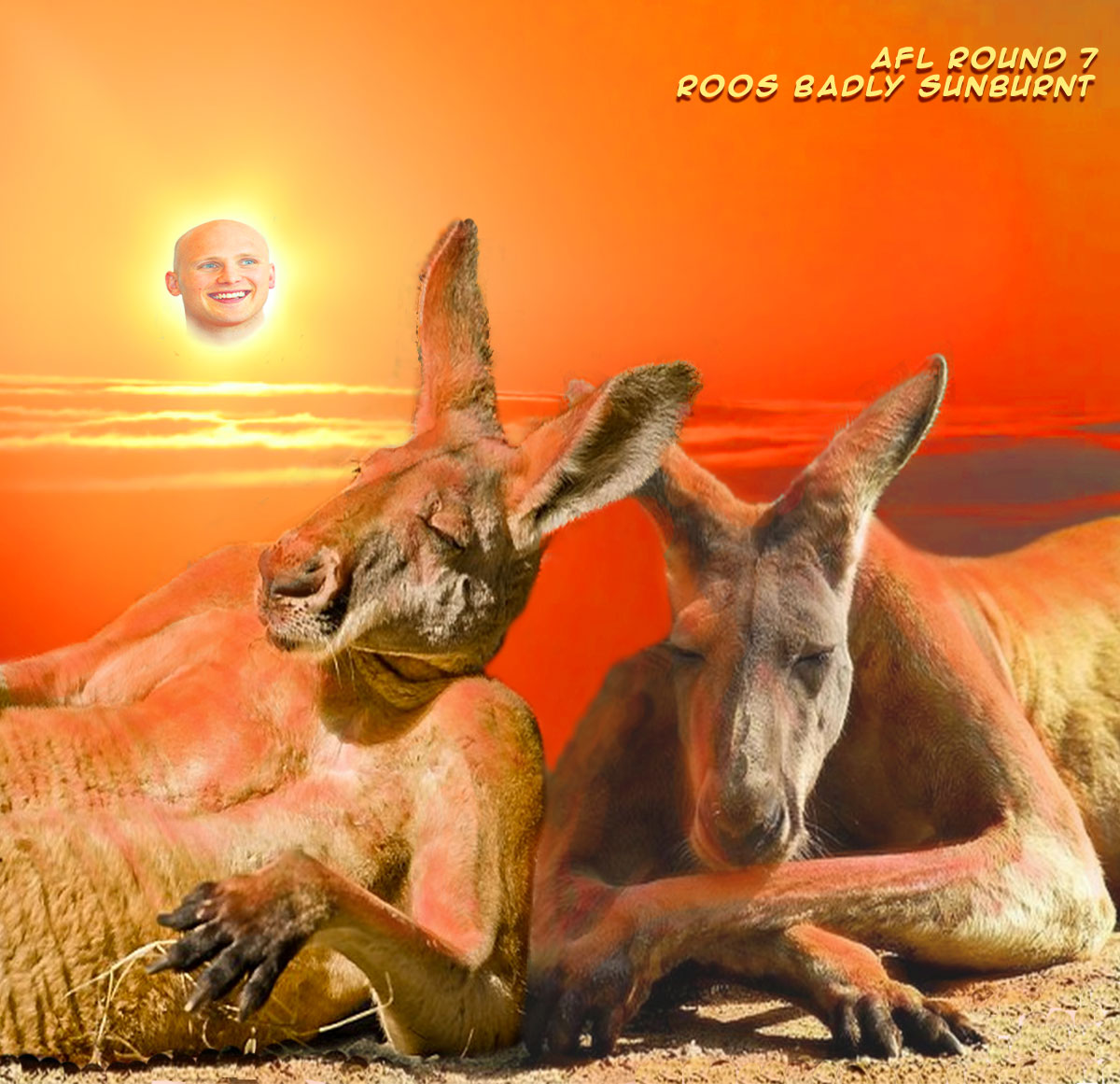 Roos Badly Sunburnt