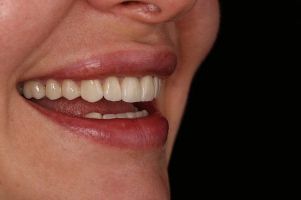 Кейс 5