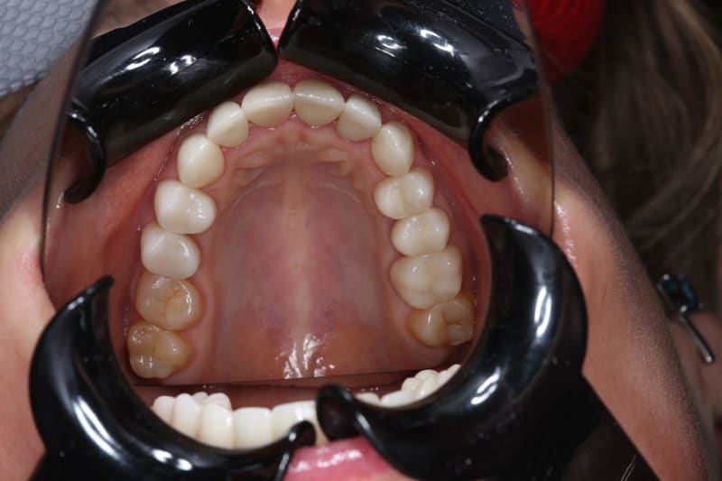 Фото 3