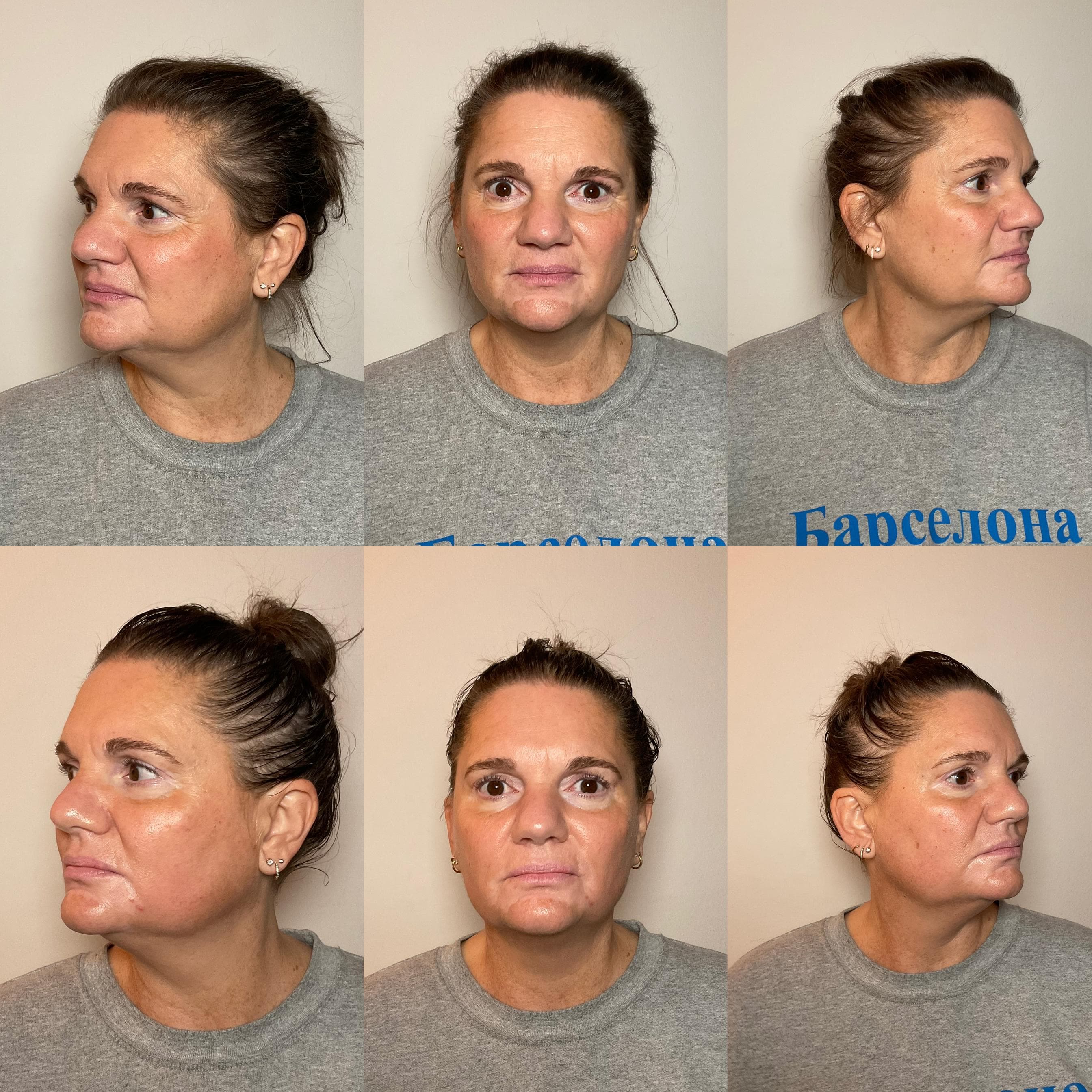 Erion Beauty treatment results - before and after holistic beauty ritual