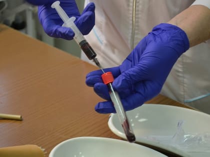 Международный день борьбы со СПИДом: факты и меры предосторожности