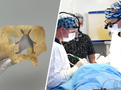 Жителю Челябинска на 3D-принтере восстановили удаленный нос