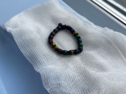 Миасские врачи спасли двухлетнего пациента