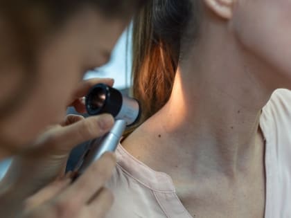 Южноуральцев приглашают бесплатно проверить родинки на онкологию