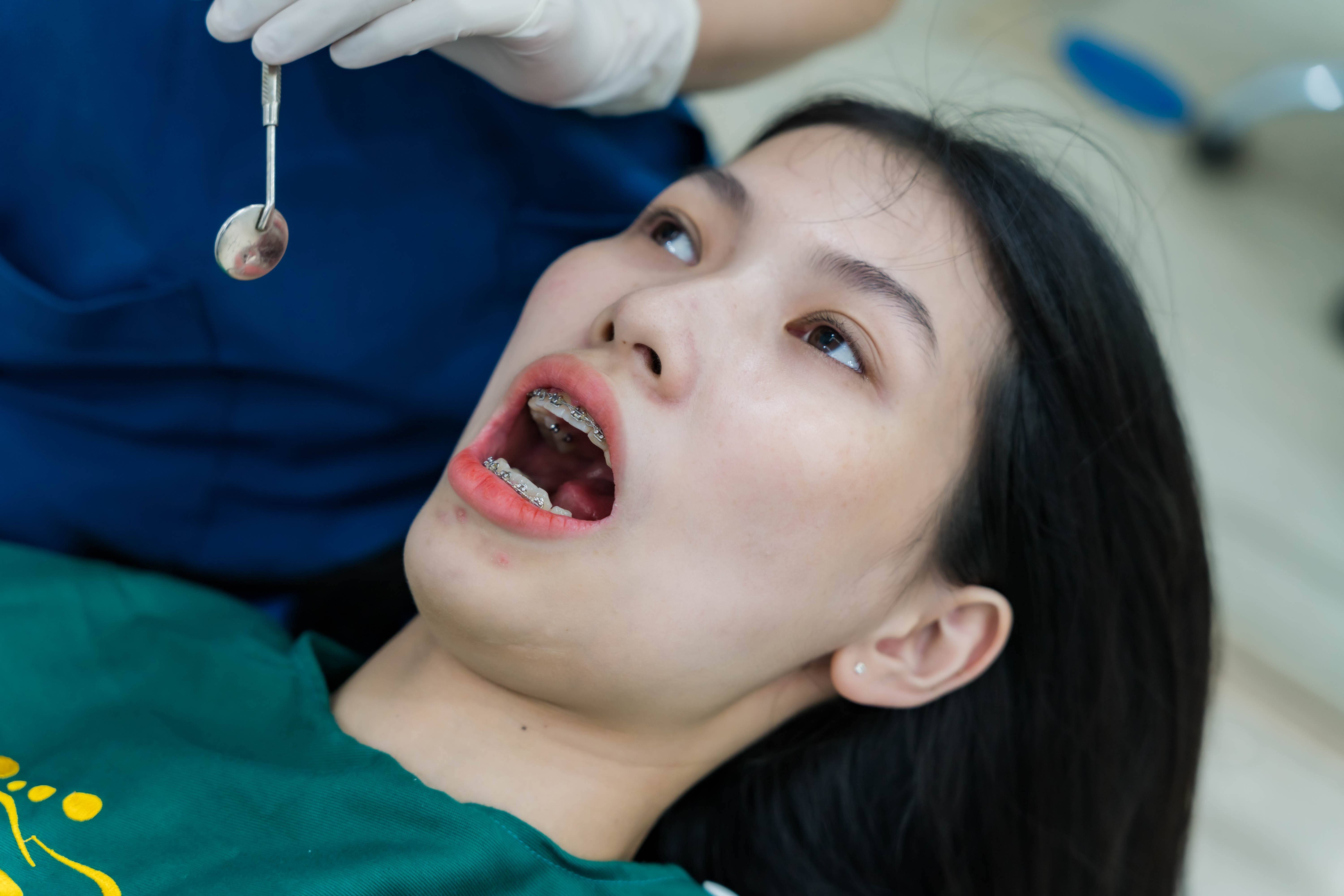 Hàn răng sâu có nguy hiểm không nếu để lâu?