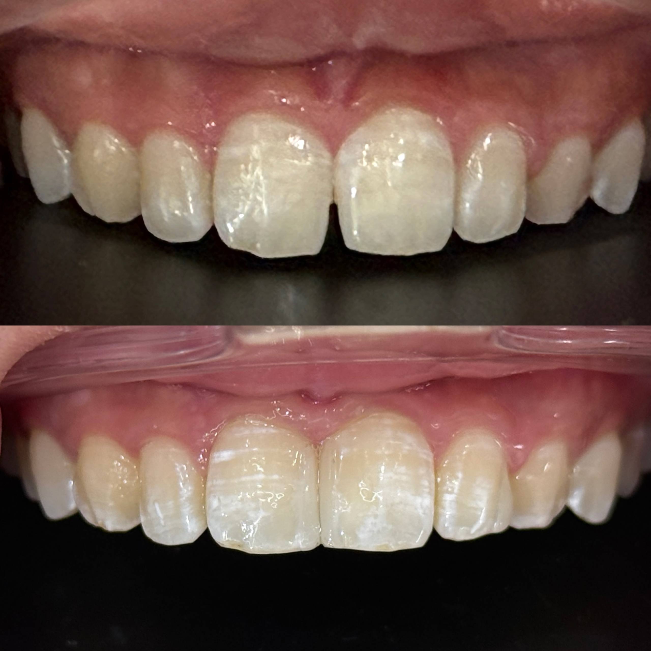 美池牙科诊所 的 无创ICON