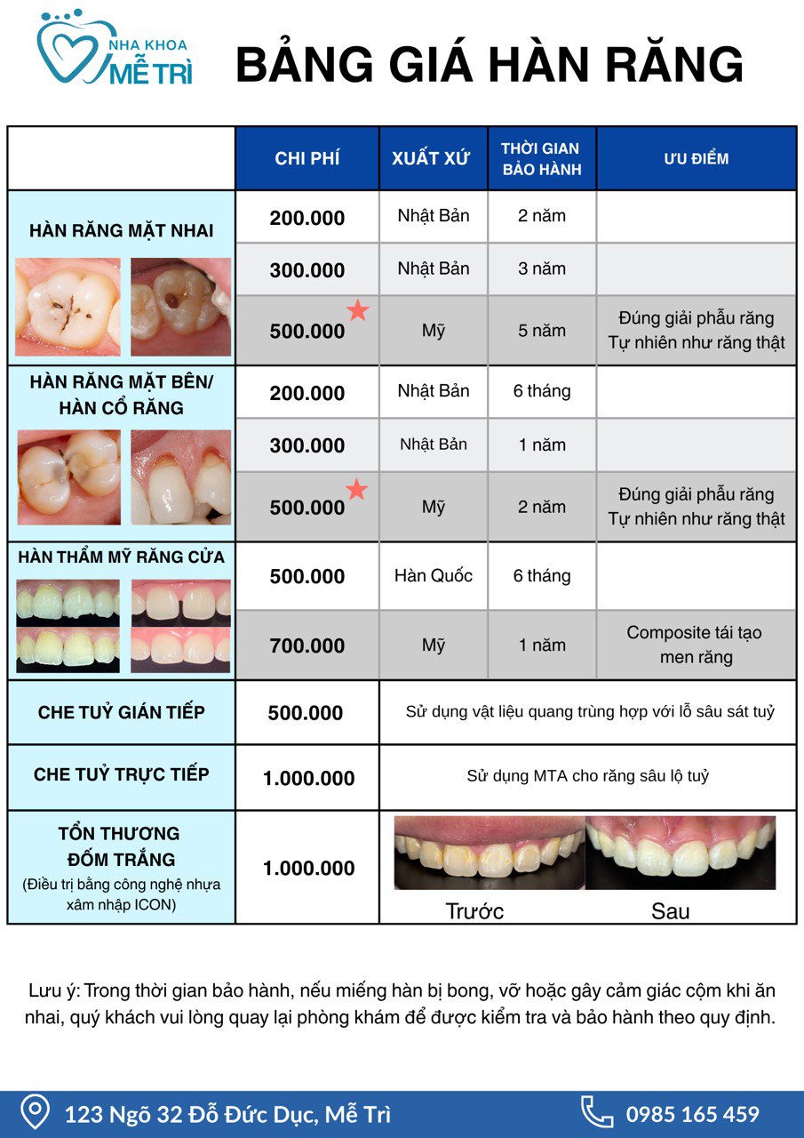 Hình ảnh bảng giá dịch vụ Hàn răng tại Nha Khoa Mễ Trì