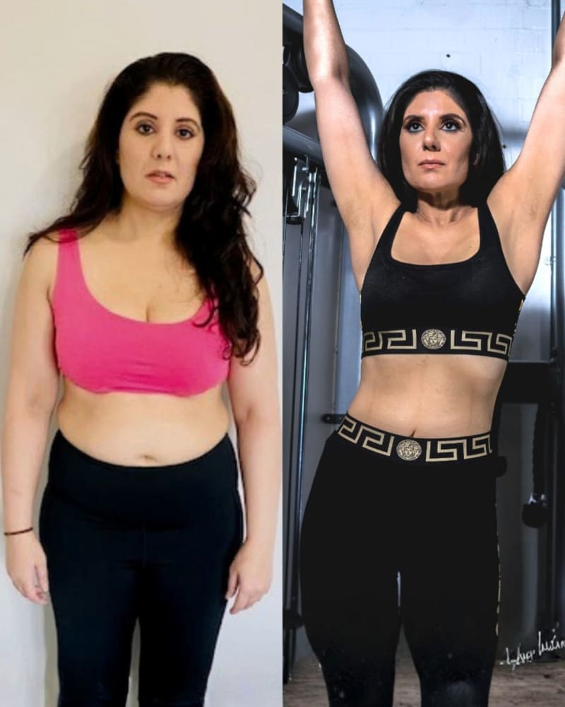 Dr. Seema Shaffi before and after