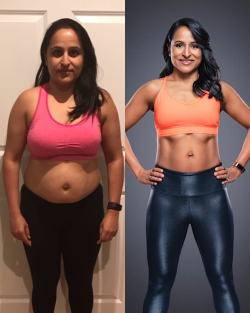 Dr. Shalini Desai before and after