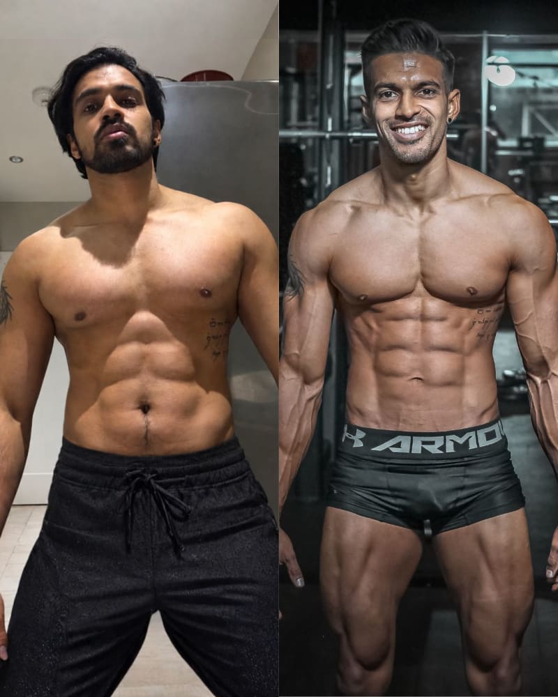 Dr. Minil Patel before and after