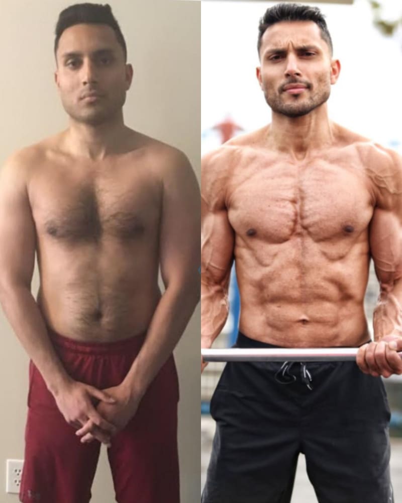 Dr. Samit before and after