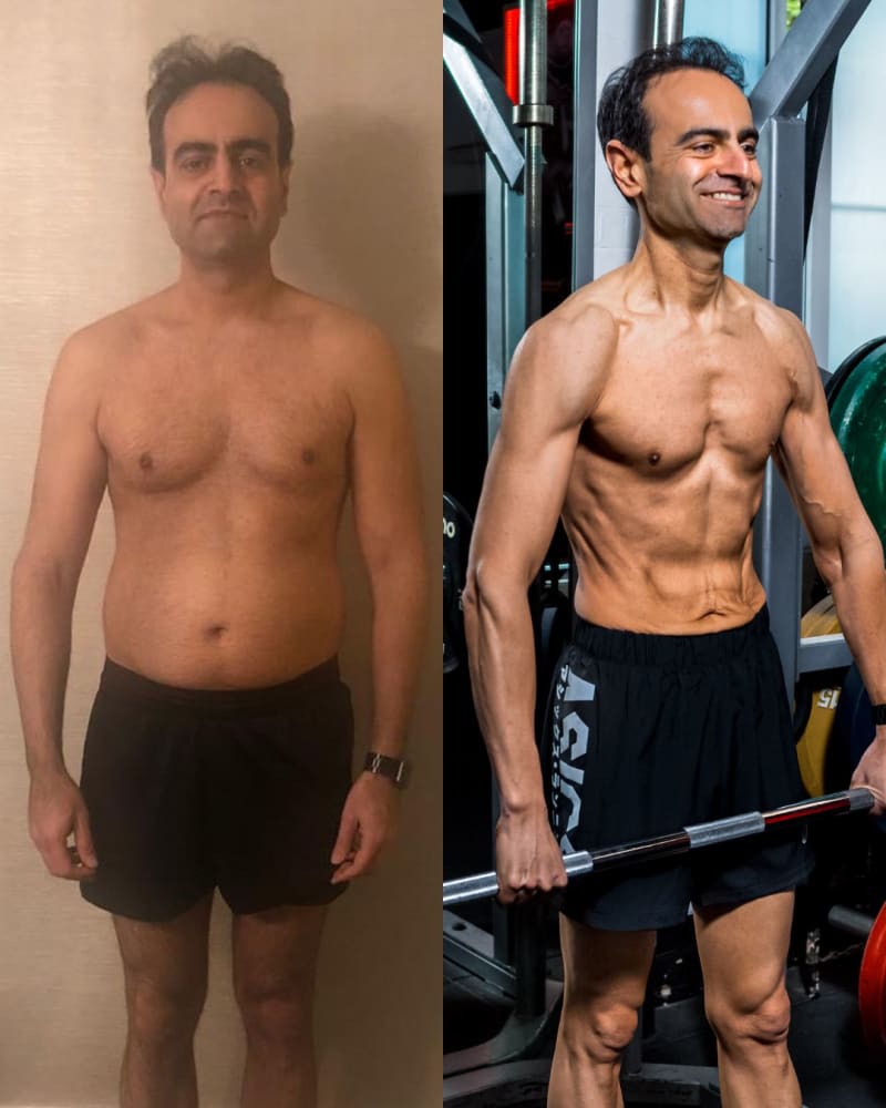 Dr. Satesh Sehdev before and after