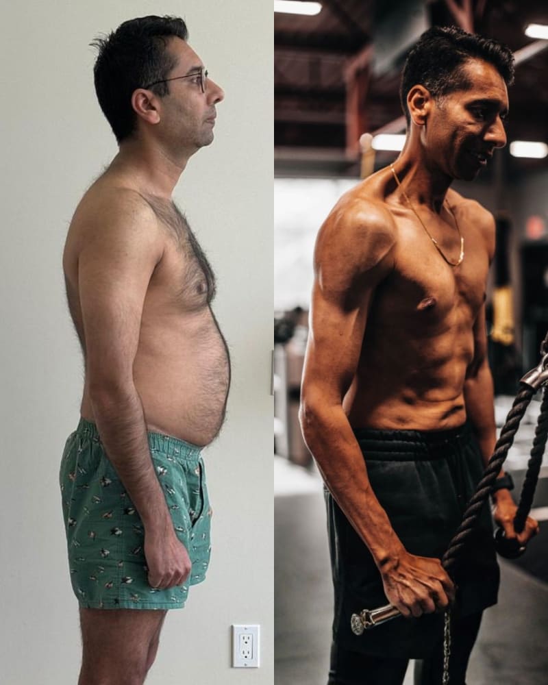 Dr. Vishal Saini before and after
