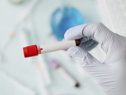 Вячеслав Гладков подтвердил информацию о случаях вирусного гепатита в соседнем Старом Осколе