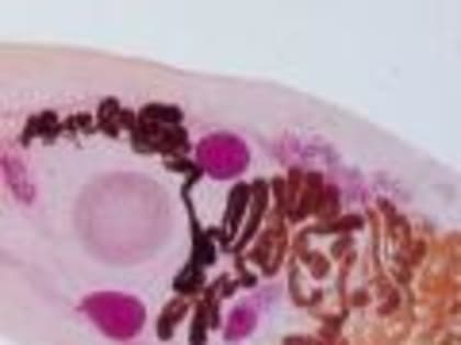 Возбудитель дикроцелиоза выявлен  диагностами Белгородской испытательной лаборатории у КРС