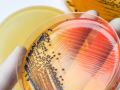 В полуфабрикатах птицы  специалистами Белгородской испытательной лаборатории обнаружены опасные патогены