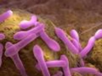 В Белгородской испытательной лаборатории проводят испытания на ботулизм