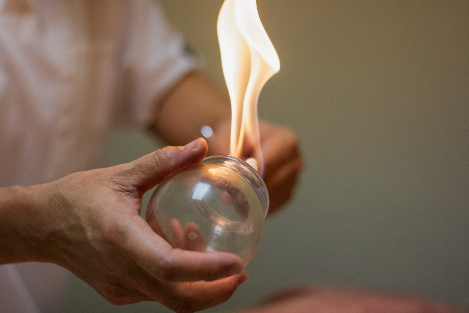 Fire Cupping Therapy in Ranchi: An Ancient Wellness Technique for Relaxation and Recovery