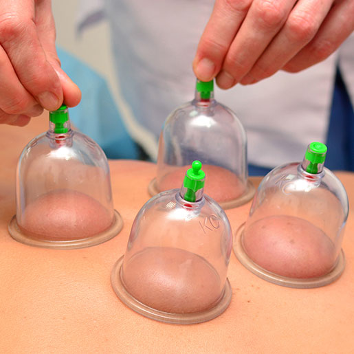 Discover the Healing Benefits of Dry Cupping Therapy in Ranchi