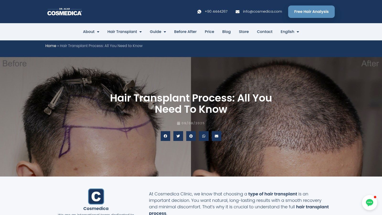 Die Website der Cosmedica Klinik, die Haartransplantationspakete detailliert beschreibt
