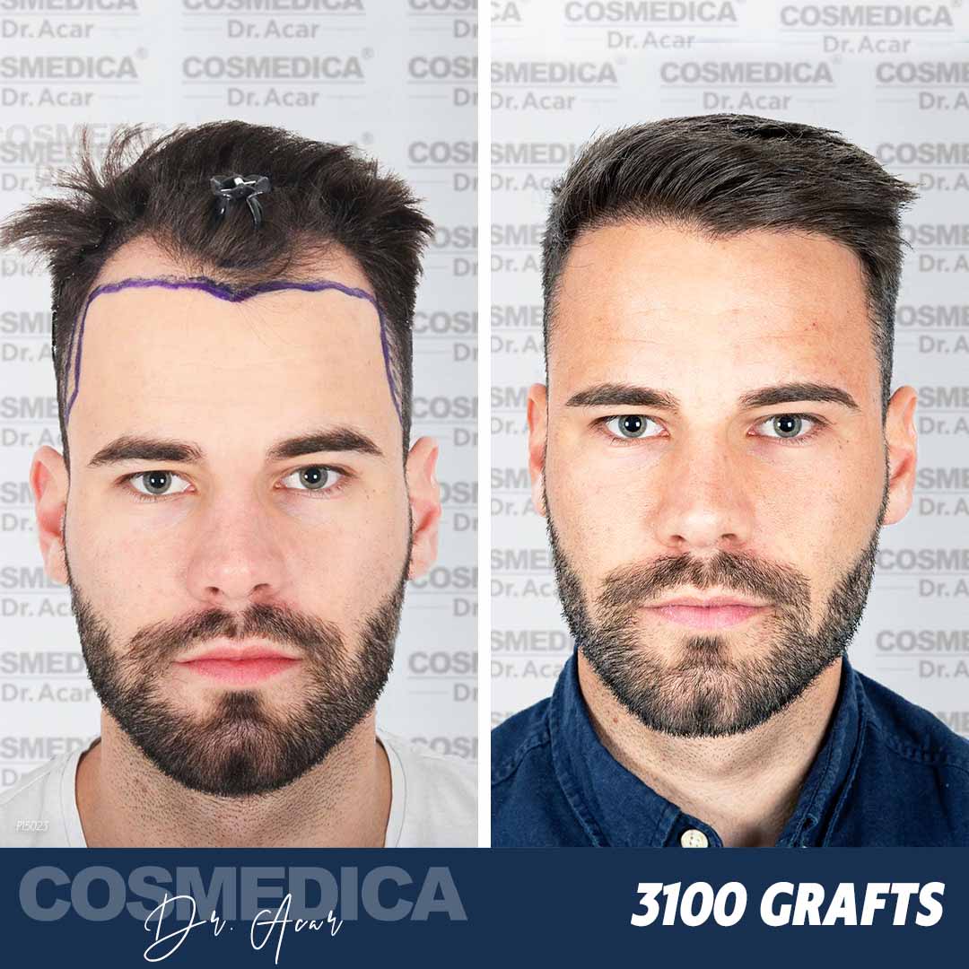 Cosmedica Hair Transplantation Clinic interior