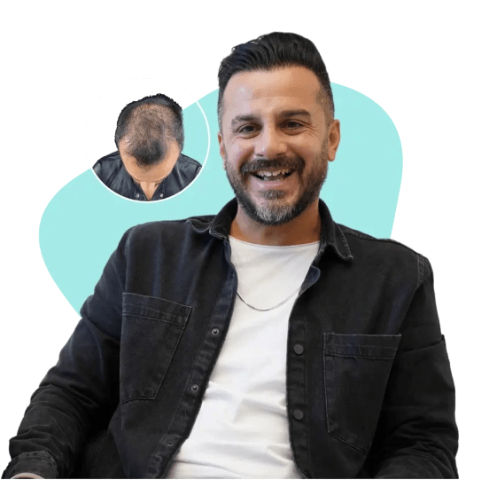 Emphair Hair Transplantation Premium Istanbul Clinic - Saç Ekimi - EMPCLINICS gallery image 1