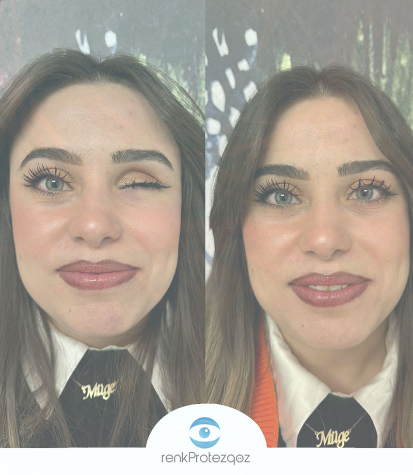 Renk Protez Göz Merkezi interior