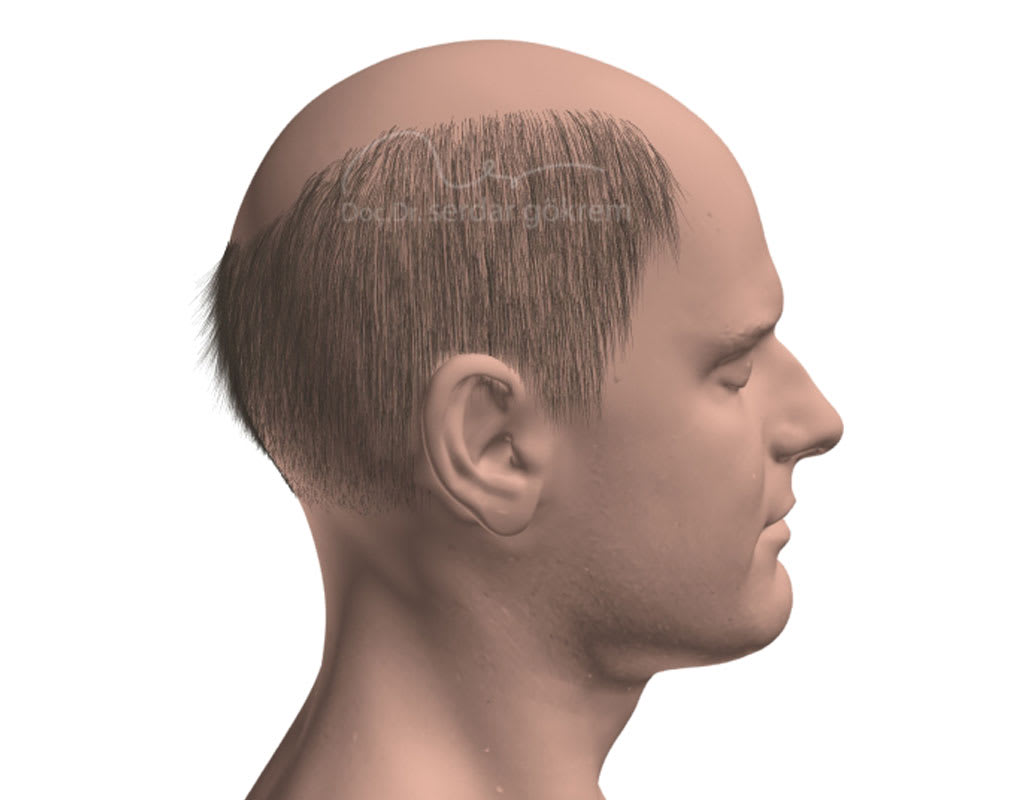 Ankara international Saç Ekimi - Doç.Dr.Serdar Gökrem interior