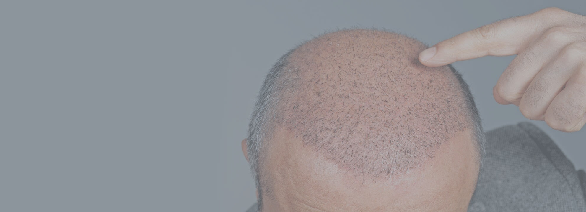 AY-MP Hair & Esthetics & Laser Hair Removal Antalya interior