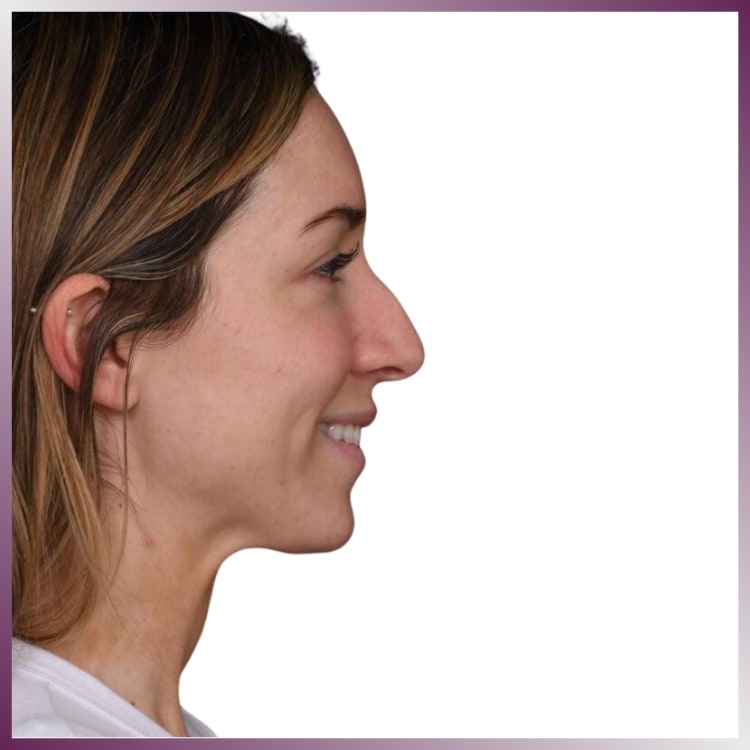 West Aesthetics gallery image 3