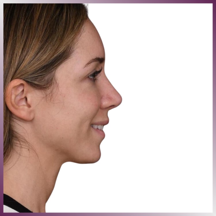 West Aesthetics gallery image 4