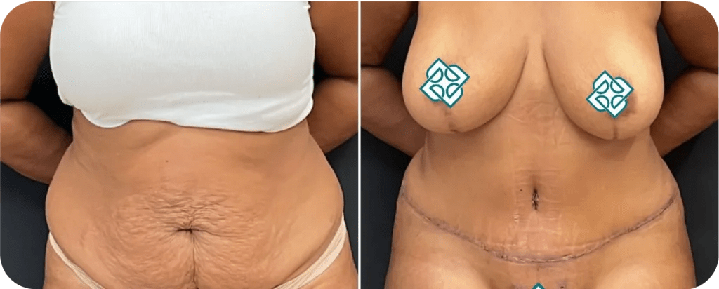 Op. Dr. Burak Pasinlioğlu - Plastik Cerrahi Kliniği gallery image 1