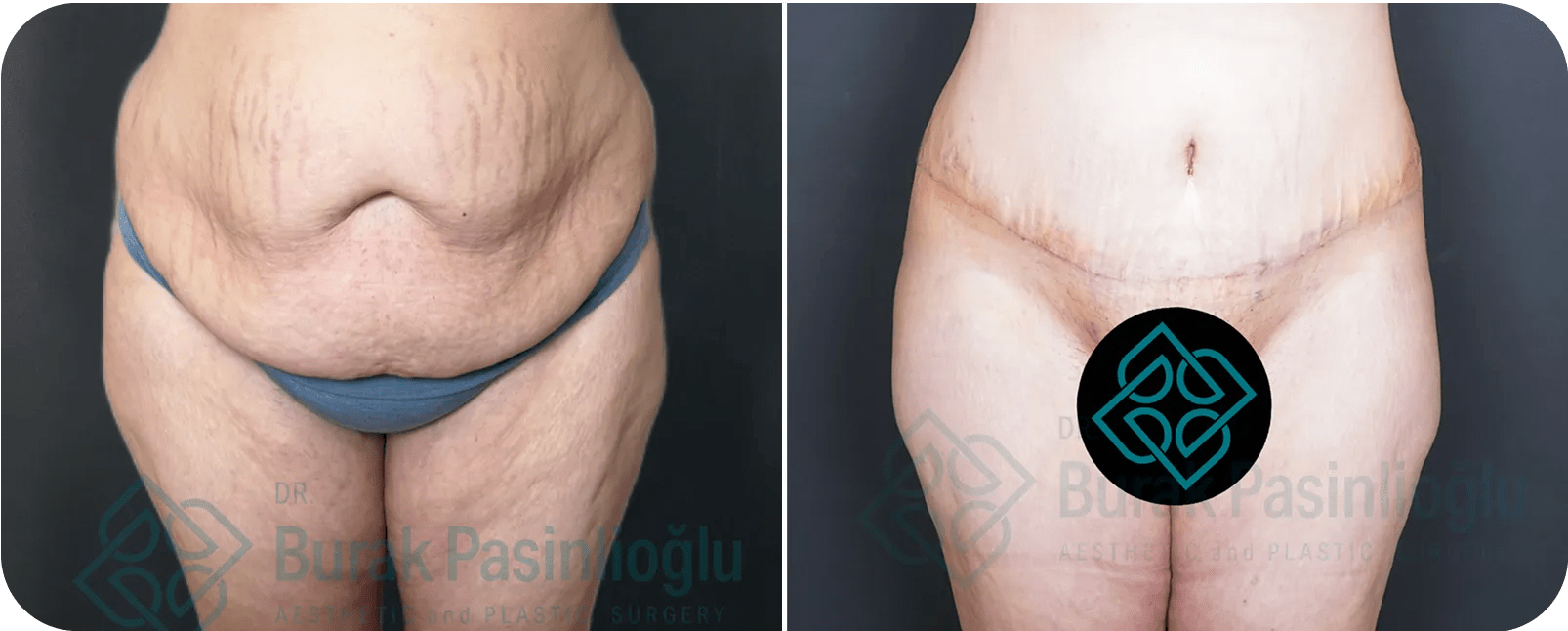 Op. Dr. Burak Pasinlioğlu - Plastik Cerrahi Kliniği gallery image 2