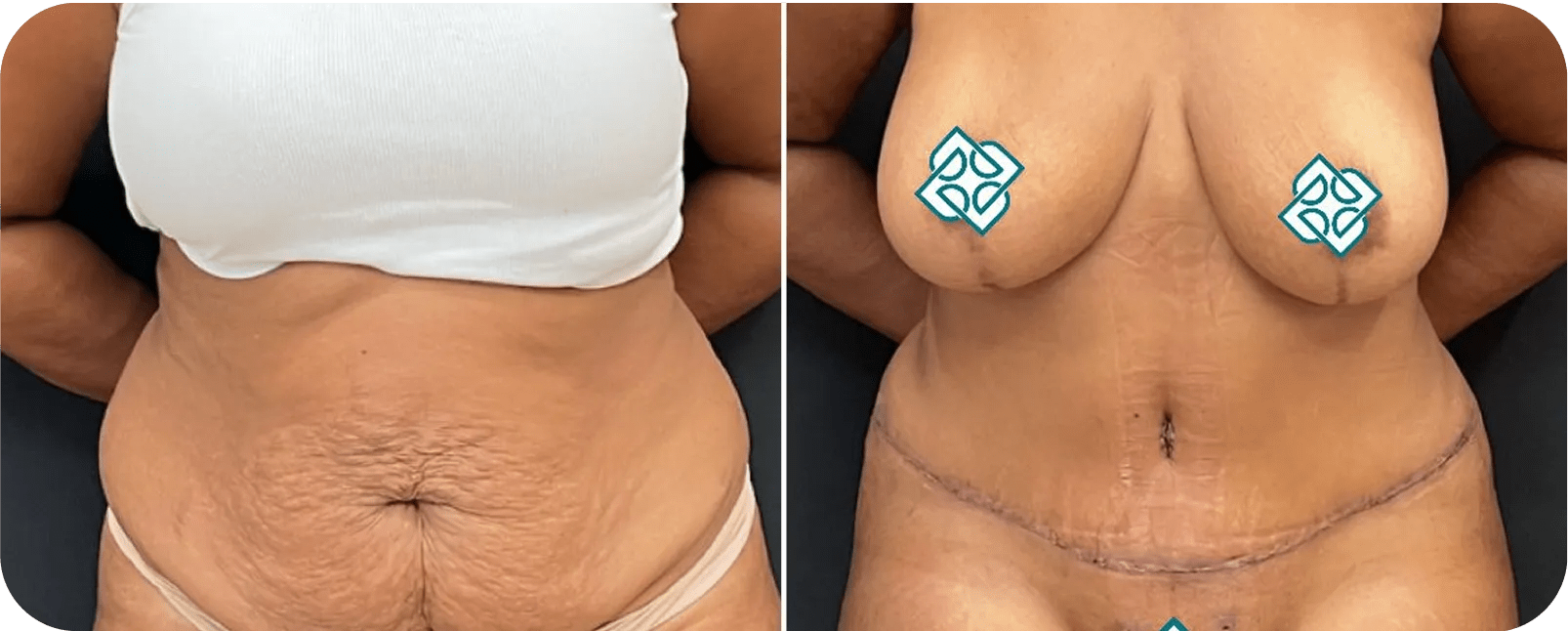 Op. Dr. Burak Pasinlioğlu - Plastik Cerrahi Kliniği gallery image 3