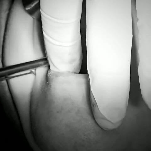 ALTAN KLİNİK | DİŞ HEKİMİ FİKRET ALTAN | İmplant, Zirkonyum, Gülüş Tasarımı, Diş Beyazlatma, Estetik Diş | Maslak İSTANBUL gallery image 1