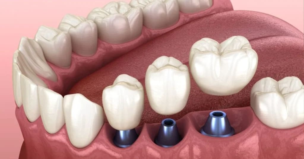 Beydent Agiz ve Dis Saglik Merkezi gallery image 4