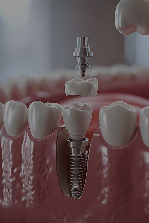 Özel Bağcılar Ağız ve Diş Sağlığı Merkezi gallery image 1