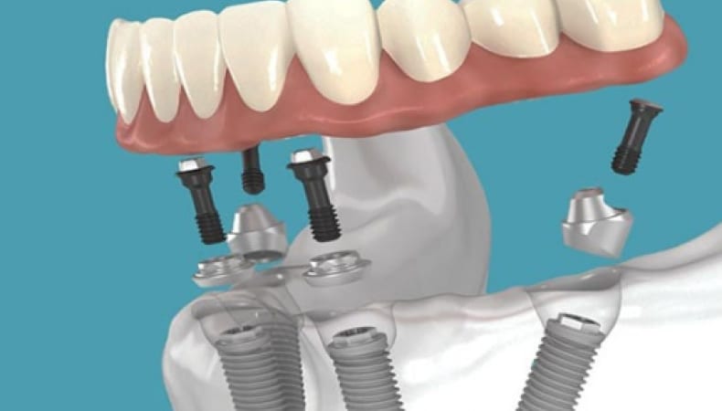 Sina Clinic Ağız ve Diş Sağlığı Merkezi interior